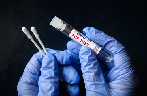 COVID 19 test RT PCR conditions remboursement